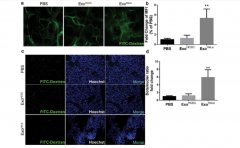 博天堂在线水抑制TGF-β1/α-SMA/Col1α1通路调控内质