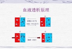 分子氢对腹膜透析患者超滤功能影响的临床和机制研究