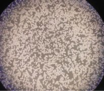 含氢培养液对脂多糖致Raw264.7巨噬细胞炎症反应的影响