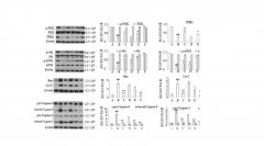 PI3K/Akt信号通路在博天堂在线水减轻心肺转流致大鼠心肌损伤中的作用