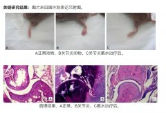 氢气在治疗类风湿关节炎中的作用及机制研究