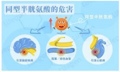 氢气改善高同型半胱氨酸血症中的作用及机制研究