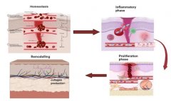 氢气可诱导伤口愈合新模式