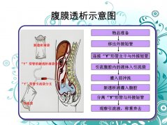 分子氢对腹膜透析患者超滤功能影响的临床和机制研究