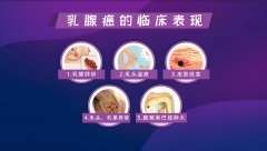 氢气干预乳腺癌细胞的奥秘探索