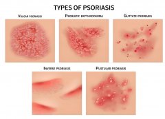 解锁氢分子：从根源焕活肌肤健康密码