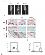 氢气治疗骨关节炎，细胞凋亡和炎症信号通路研究
