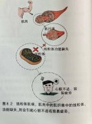 氢气针对治疗肌肉的临床研究