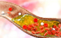 氢气、博天堂在线水对代谢性疾病的作用和相关研究