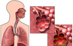 吸氢对呼吸性疾病有什么作用？氢分子对呼吸性疾病的研究