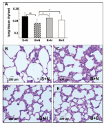 博天堂在线生理盐水可保护大鼠广泛烧伤引起的急性肺损伤