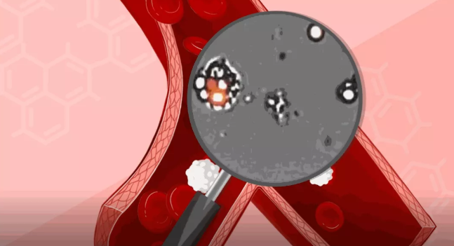 百篇科普系列（1）| 次氯酸是什么？