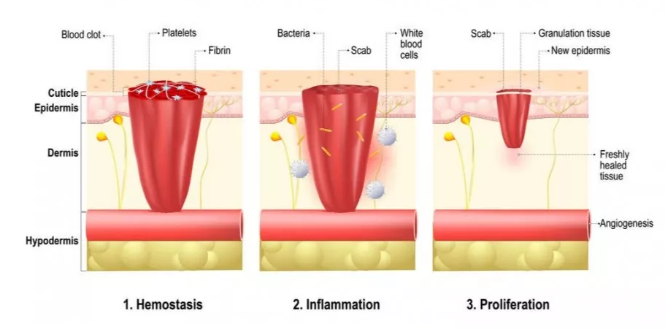 百篇科普系列（2）| 次氯酸具备哪些功能？