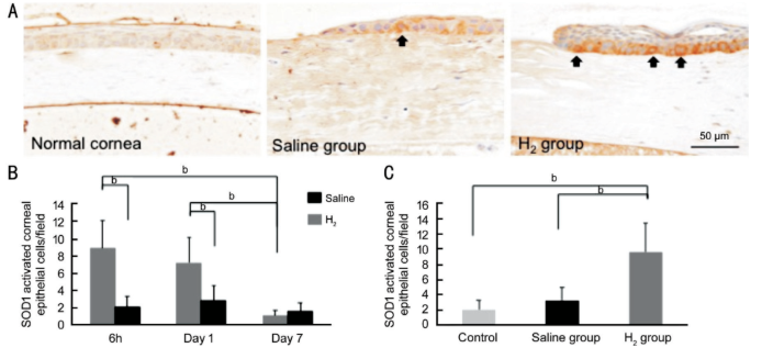 哇SOD吗？氢气通过SOD发挥抗炎作用！