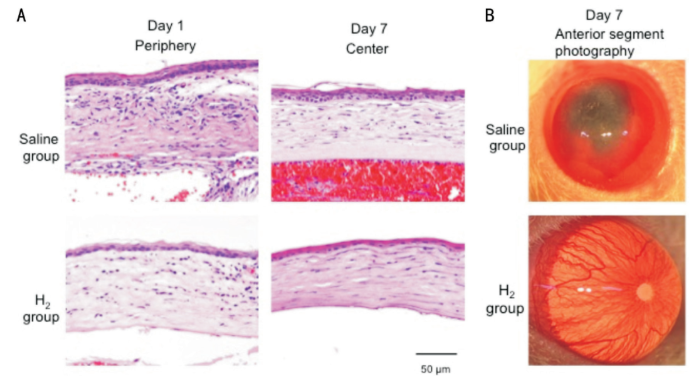 哇SOD吗？氢气通过SOD发挥抗炎作用！