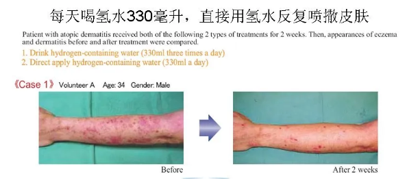 氢气凭什么如此牛？