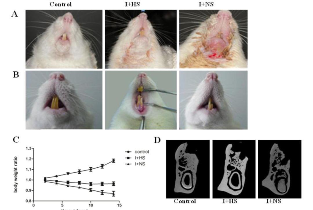 放射骨坏死难治，神勇氢气不妨一试！