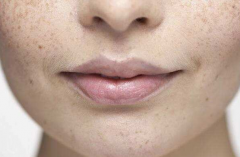 氢力泉祛斑小妙招，做个无暇美人