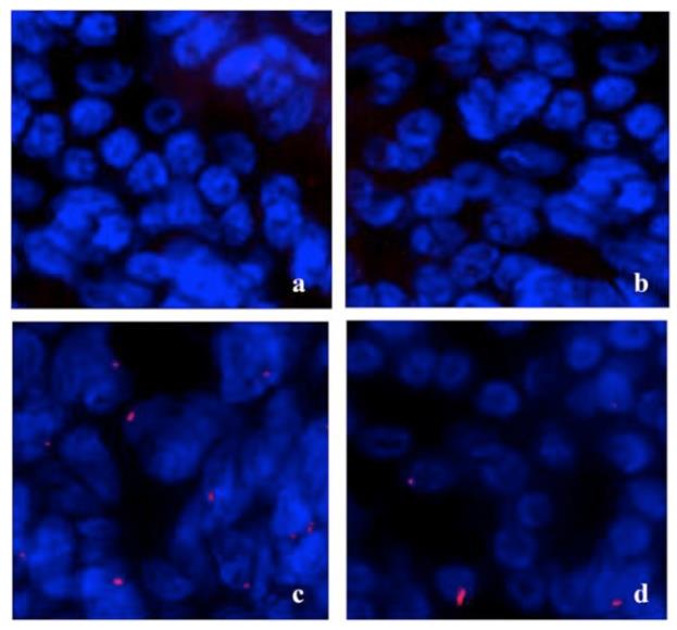 同济大学：氢水适用于过敏性鼻炎