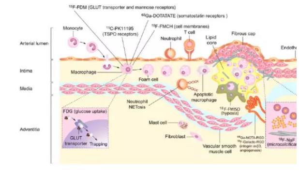 应激诱发心血管事件，氢气或可挽救生命