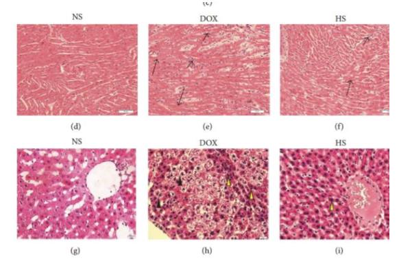 氢气对化疗药阿霉素副作用的对抗作用