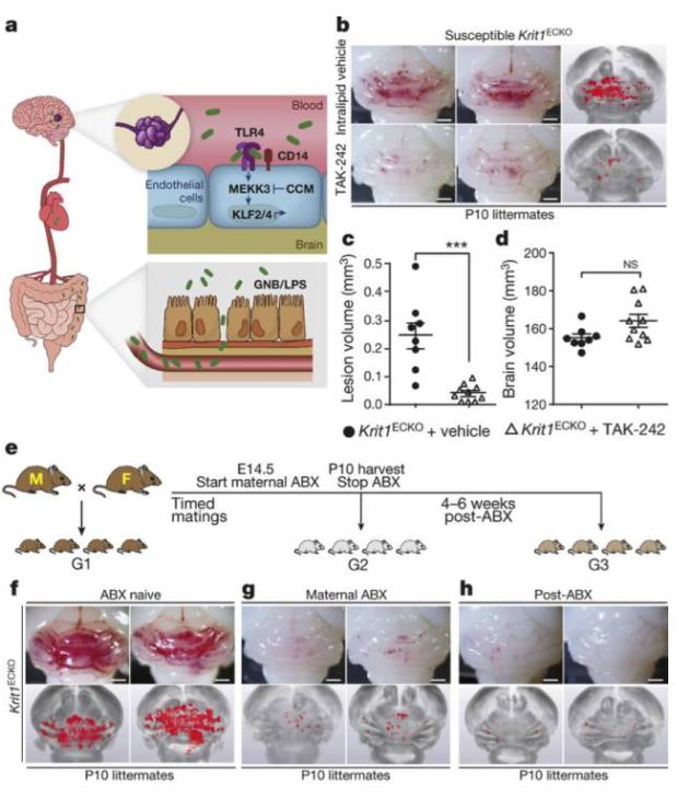 调节菌群可预防中风，氢气可以先行