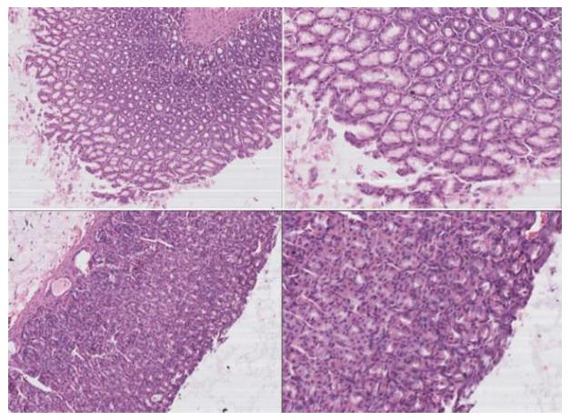 西安交大：氢水改善胃溃疡