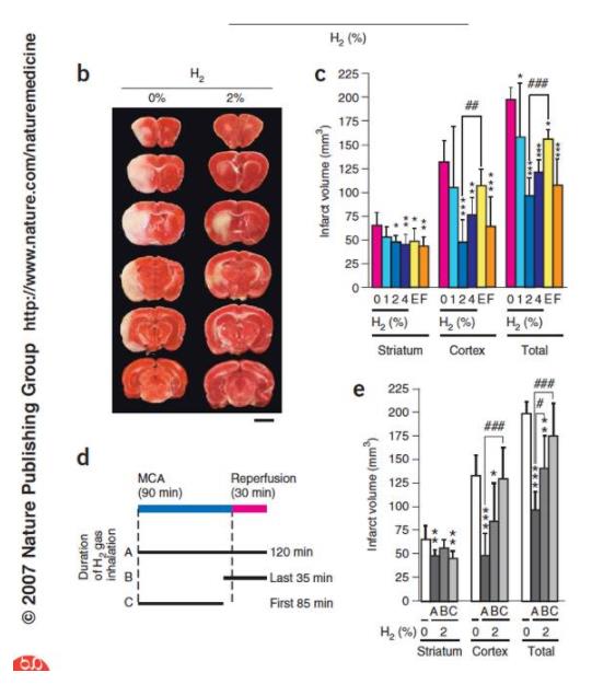 氢气是一种独特的医学气体