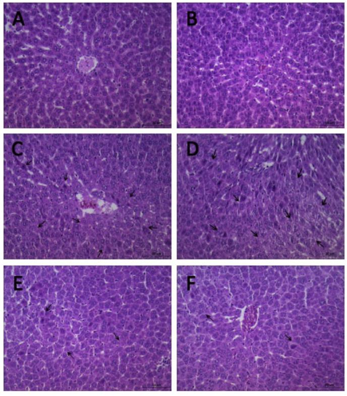 新领域：氢气对气腹肝损伤的保护作用