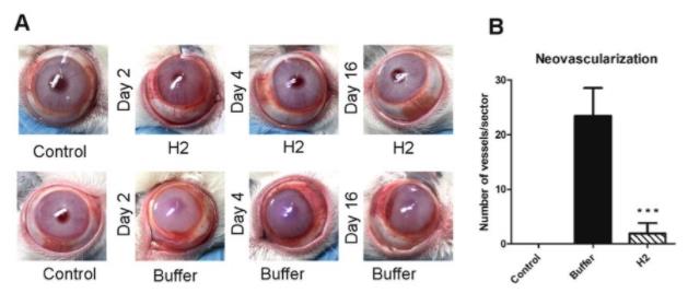 雪盲，氢水改善眼部疾病的相关介绍