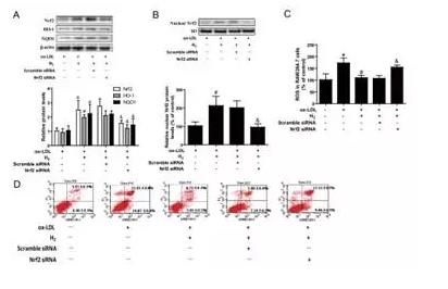 动脉斑块是生命隐形炸弹，饮用氢水能稳定动脉斑块