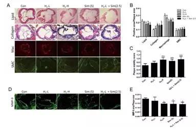 动脉斑块是生命隐形炸弹，饮用氢水能稳定动脉斑块