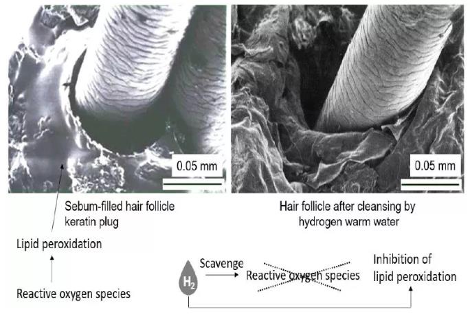 泡氢水美容！人体试验证据，氢靓！