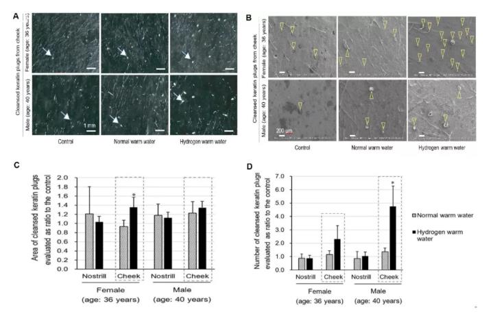 氢水促进微循环，也能去黑头！厉害！