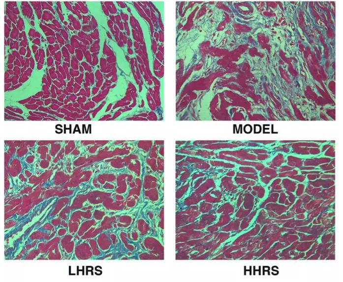 氢气抗心衰，救命效应又添新证据！