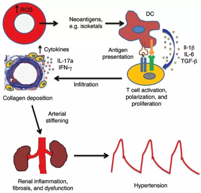 高血压存在氧化应激和炎症，氢气抗高血压值得期待