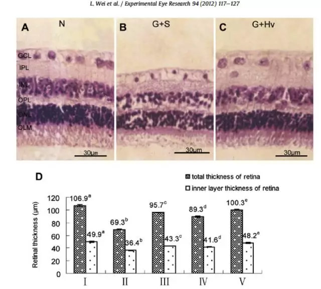 泰山医学院：氢气对视网膜兴奋毒性的保护作用