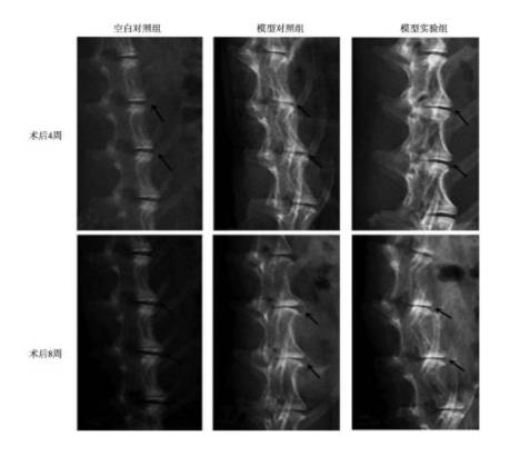 博天堂在线水对兔腰椎间盘退变的影响