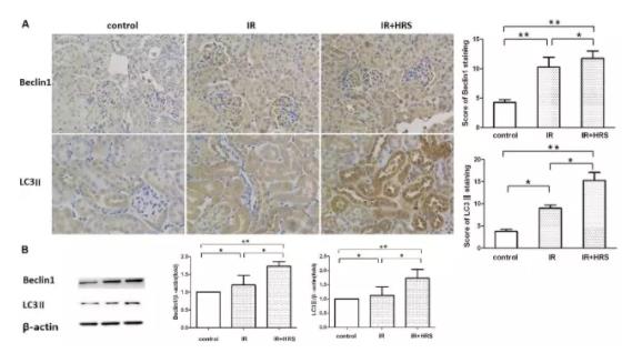 复旦：氢水预防慢性肾脏病的研究