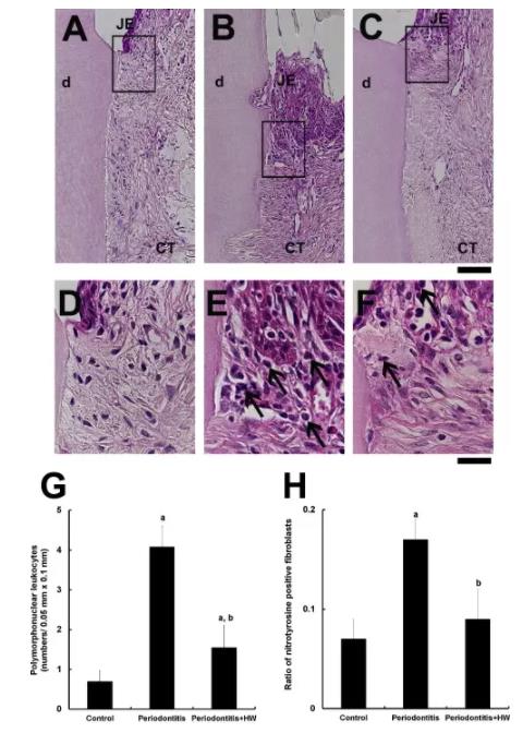 牙周炎可诱导动脉硬化，氢气能改善！