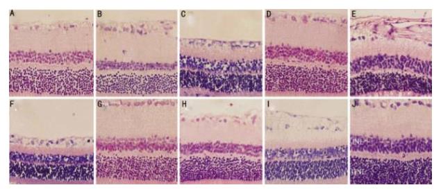 华中科大：氢气对蓝光诱导视损伤的保护作用