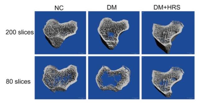 新功能：氢水预防糖尿病骨质疏松