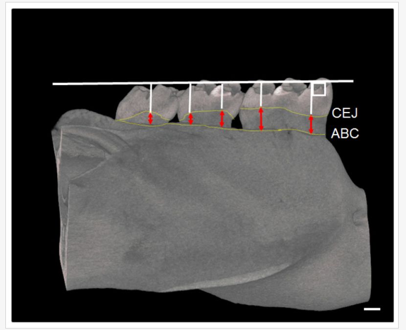 博天堂在线水对牙龈氧化应激和牙槽骨吸收的预防作用