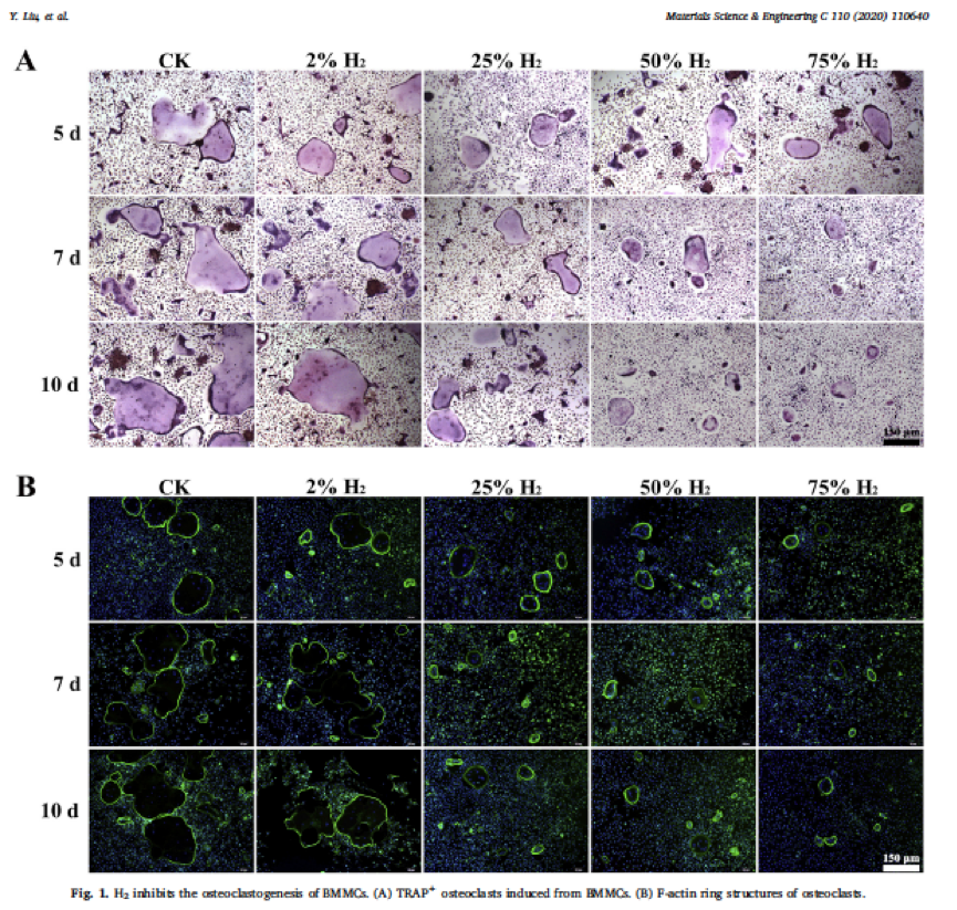 氢气能不能改善骨质疏松？细胞学机制在这里