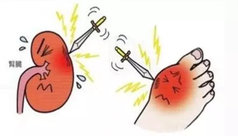 血糖、尿酸、血脂一网打。馑寮毂ǜ