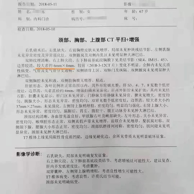 肺结节纠结，吸氢气释怀