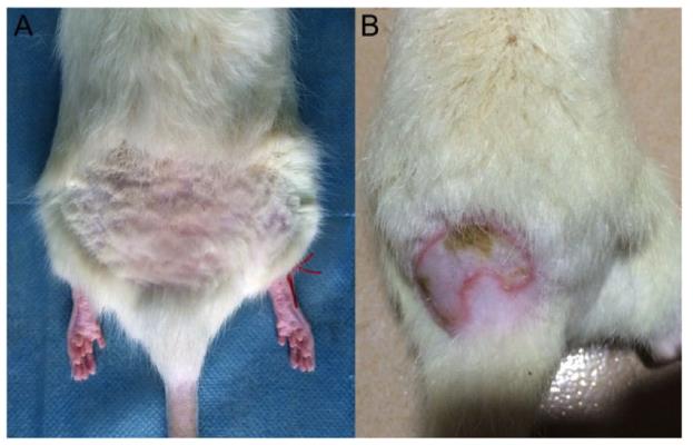 氢水能够改善放射性皮肤。咛逍Ч杉