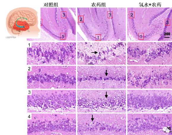 氢气生物学机理：氢气与乙酰胆碱酯酶
