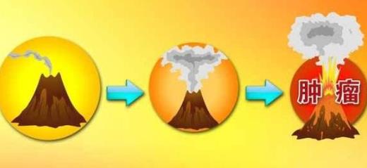 研究癌症一辈子，院士为何劝人别轻易开刀？！氢阅读