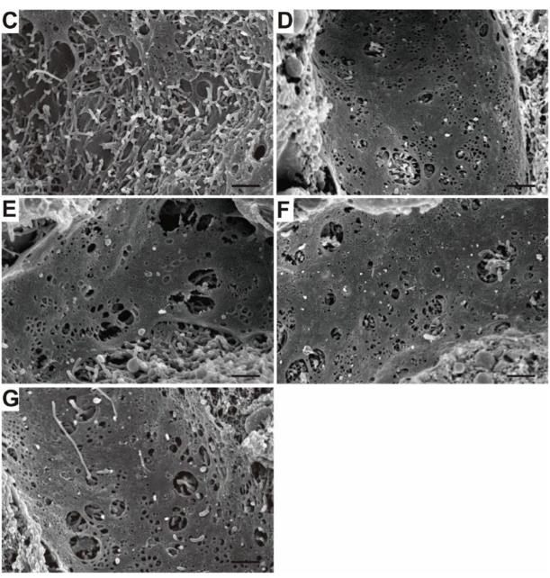 氢气保护肝脏的研究实验，值得一看！